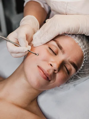 ÁCIDO Hialurónico - Pómulos