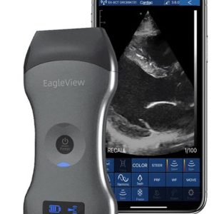 Ultrasonido portátil